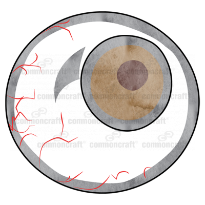 Eyeball Capillaries