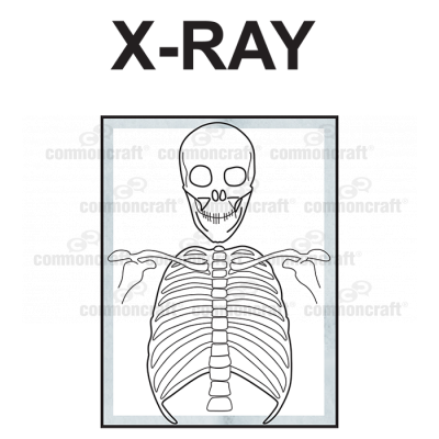 XRay